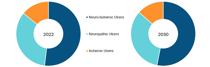 Diabetic Foot Ulcer Market, by Ulcer Type  – 2022 and 2030