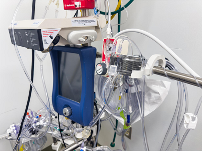 Cardiopulmonary Oxygenator Market Trends & Innovations You Should Know