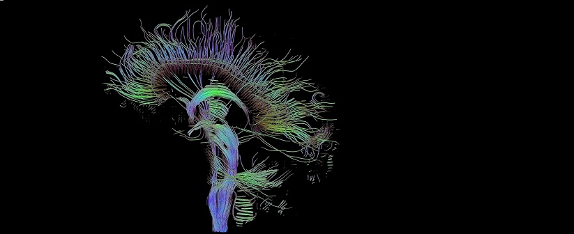 Interventional Neuroradiology Market