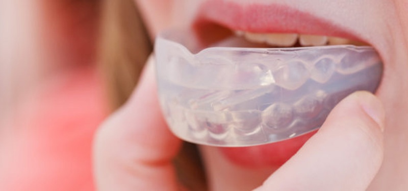 Sports Mouthguard Market